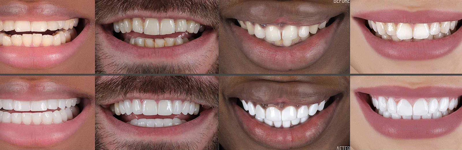 Gallery Florida Dental Cosmetic