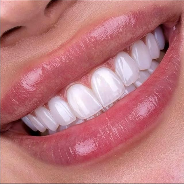 Dental Care - Florida Dental Cosmetic