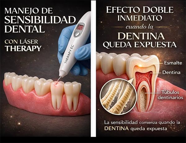 Tooth Sensitivity. Florida Dental Cosmetic