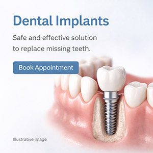 Dental Implant - Florida Dental Cosmetic